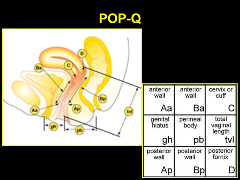 POP-Q